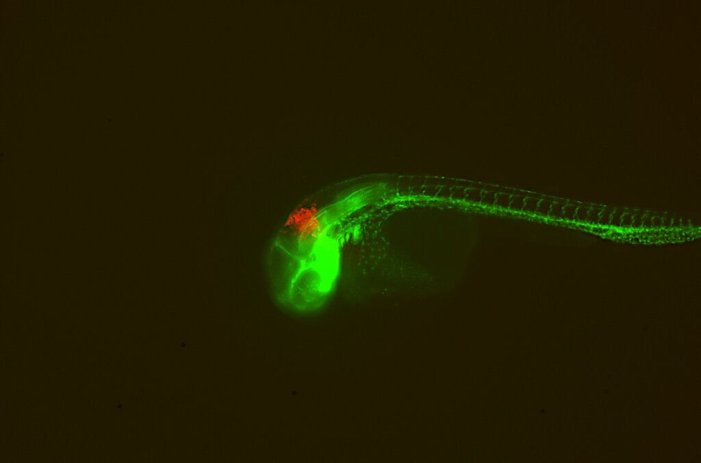 Zebrafisk_Brain tumor_FotoLars Bräutigam.tif