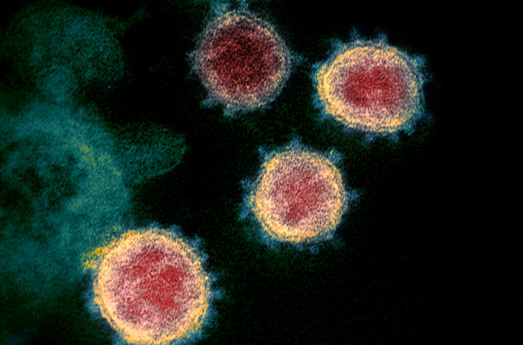 Novel Coronavirus SARS CoV 2