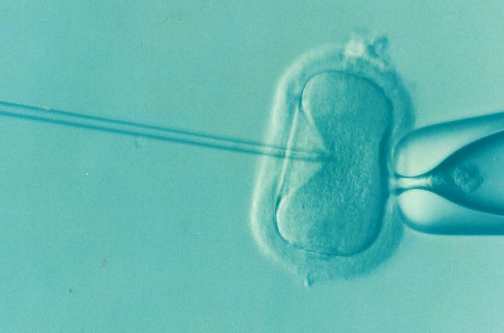 Ivf.png