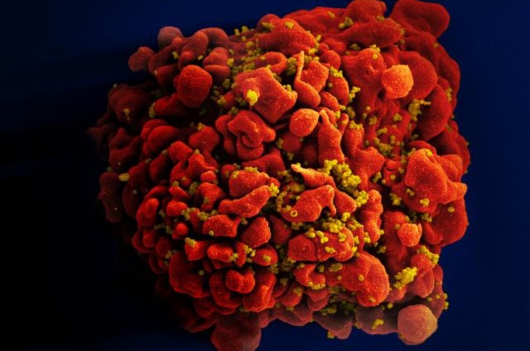 HIV-infekterad H9 T cell