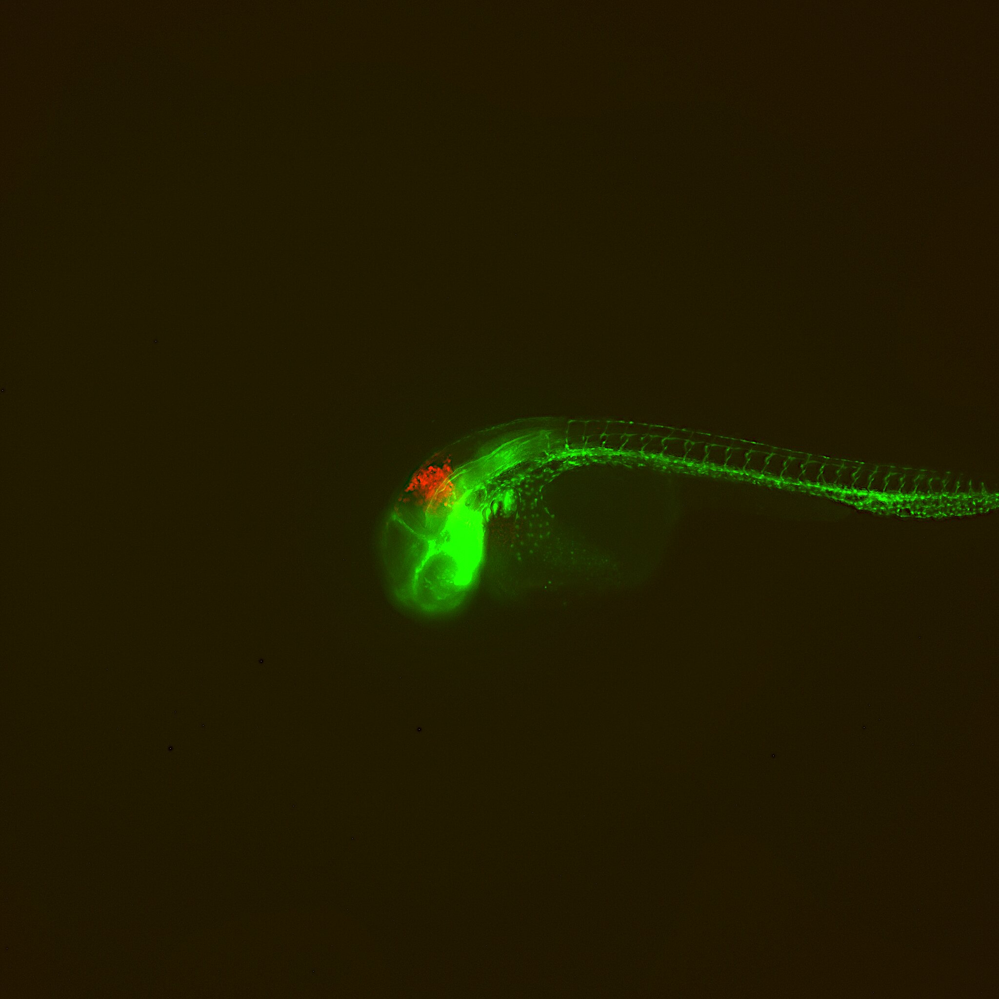 Zebrafisk_Brain tumor_FotoLars Bräutigam.tif