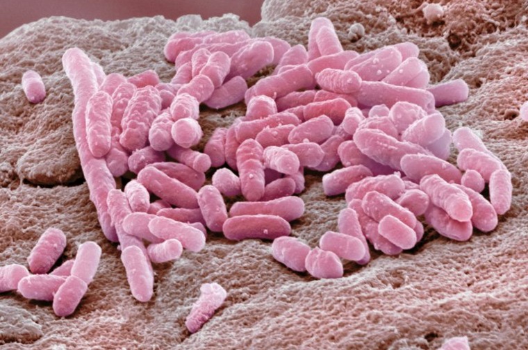 E Coli